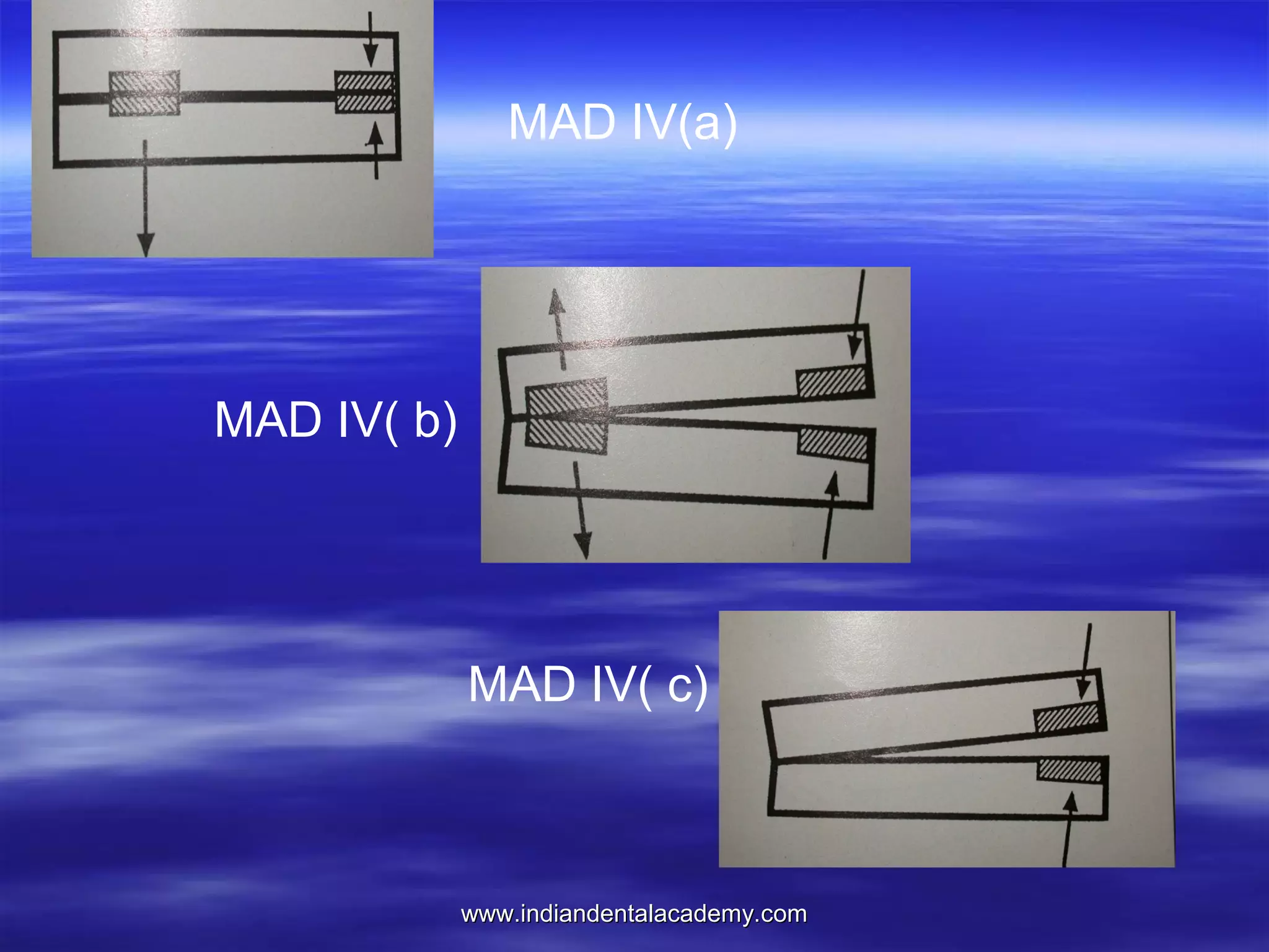 MAD IV(a)

MAD IV( b)

MAD IV( c)

www.indiandentalacademy.com

 