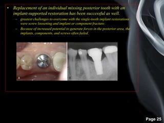 Page 25
• Replacement of an individual missing posterior tooth with an
implant-supported restoration has been successful as well.
– greatest challenges to overcome with the single-tooth implant restorations
were screw loosening and implant or component fracture.
– Because of increased potential to generate forces in the posterior area, the
implants, components, and screws often failed.
 