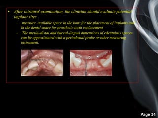 Page 34
• After intraoral examination, the clinician should evaluate potential
implant sites.
– measure available space in the bone for the placement of implants and
in the dental space for prosthetic tooth replacement
– The mesial-distal and buccal-lingual dimensions of edentulous spaces
can be approximated with a periodontal probe or other measuring
instrument.
 