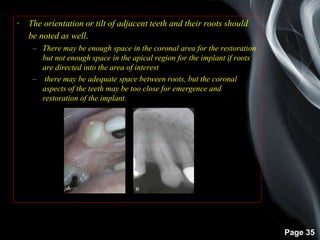 Page 35
• The orientation or tilt of adjacent teeth and their roots should
be noted as well.
– There may be enough space in the coronal area for the restoration
but not enough space in the apical region for the implant if roots
are directed into the area of interest
– there may be adequate space between roots, but the coronal
aspects of the teeth may be too close for emergence and
restoration of the implant.
 