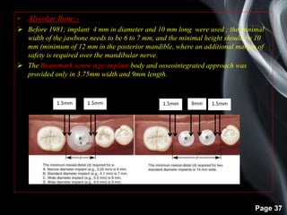 Page 37
• Alveolar Bone:-
 Before 1981; implant 4 mm in diameter and 10 mm long were used ; the minimal
width of the jawbone needs to be 6 to 7 mm, and the minimal height should be 10
mm (minimum of 12 mm in the posterior mandible, where an additional margin of
safety is required over the mandibular nerve.
 The Branemark screw type implant body and osseointegrated approach was
provided only in 3.75mm width and 9mm length.
 