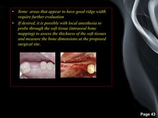Page 43
• Some areas that appear to have good ridge width
require further evaluation
• If desired, it is possible with local anesthesia to
probe through the soft tissue (intraoral bone
mapping) to assess the thickness of the soft tissues
and measure the bone dimensions at the proposed
surgical site.
 