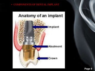 Page 9
• COMPONENTS OF DENTAL IMPLANT
 