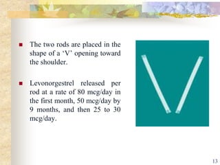  The two rods are placed in the
shape of a ‘V’ opening toward
the shoulder.
 Levonorgestrel released per
rod at a rate of 80 mcg/day in
the first month, 50 mcg/day by
9 months, and then 25 to 30
mcg/day.
13
 