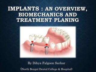 IMPLANTS : AN OVERVIEW,
BIOMECHANICS AND
TREATMENT PLANING
By Dibya Falgoon Sarkar
(North Bengal Dental College & Hospital)
 