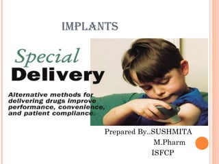 IMPLANTS
Prepared By..SUSHMITA
M.Pharm
ISFCP
 