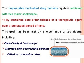 The Implantable controlled drug delivery system achieved
with two major challenges.
1) by sustained zero-order release of ...