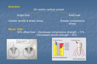 Direction
On centric vertical contact
Angle load Axial load
Greater tensile & shear stress Greater compressive
stress
Misch 1994
30% offset load – Decreases compressive strength – 11%
- Decreases tensile strength – 25%
 