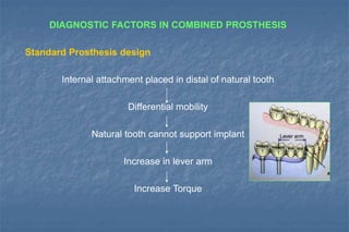 DIAGNOSTIC FACTORS IN COMBINED PROSTHESIS
Standard Prosthesis design
Internal attachment placed in distal of natural tooth
Differential mobility
Natural tooth cannot support implant
Increase in lever arm
Increase Torque
 