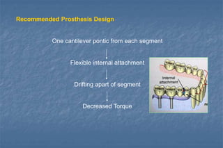 Recommended Prosthesis Design
One cantilever pontic from each segment
Flexible internal attachment
Drifting apart of segment
Decreased Torque
 
