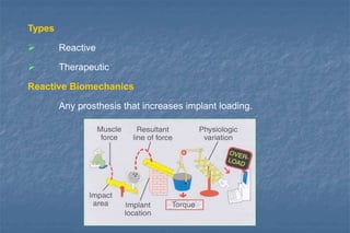 Types
 Reactive
 Therapeutic
Reactive Biomechanics
Any prosthesis that increases implant loading.
 