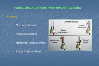 FOUR CLINICAL VARIANT WITH IMPLANT LOADING
Includes
 Cuspal inclination
 Implant inclination
 Horizontal Implant Offset
 Apical Implant Offset
 