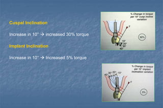 Cuspal Inclination
Increase in 10°  increased 30% torque
Implant Inclination
Increase in 10°  Increased 5% torque
 