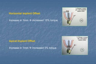 Horizontal Implant Offset
Increase in 1mm  increased 15% torque
Apical Implant Offset
Increase in 1mm  Increased 5% torque
 