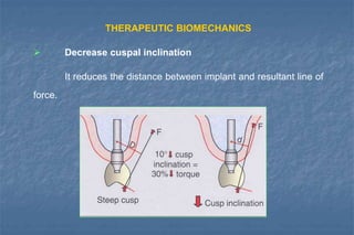 THERAPEUTIC BIOMECHANICS
 Decrease cuspal inclination
It reduces the distance between implant and resultant line of
force.
 