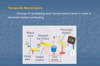 Therapeutic Biomechanics
Process of remediating each biomechanical factor in order to
deiminish implant overlaoding
 