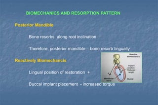 BIOMECHANICS AND RESORPTION PATTERN
Posterior Mandible
Bone resorbs along root inclination
Therefore, posterior mandible – bone resorb lingually
Reactively Biomechancis
Lingual position of restoration +
Buccal implant placement - increased torque
 
