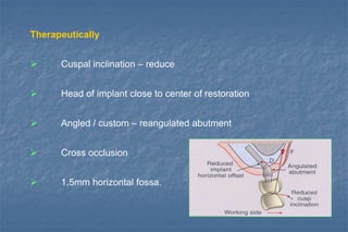 Therapeutically
 Cuspal inclination – reduce
 Head of implant close to center of restoration
 Angled / custom – reangulated abutment
 Cross occlusion
 1.5mm horizontal fossa.
 