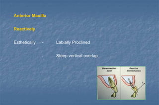 Anterior Maxilla
Reactively
Esthetically - Labially Proclined
- Steep vertical overlap
 