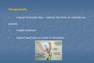 Therapeutically
 Lingual horizontal stop – redirect the force as vertically as
possible.
 Angled abutment
 Implant head close to center of restoration
 