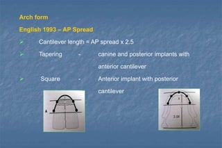IMPLANTS-Biomechanics.ppt
