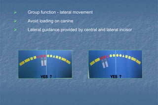  Group function - lateral movement
 Avoid loading on canine
 Lateral guidance provided by central and lateral incisor
 