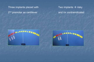 Three implants placed with Two implants  risky
2nd premolar as cantilever and /or contraindicated
 