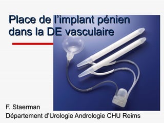 Place de l’implant pénien dans la DE vasculaire F. Staerman Département d’Urologie Andrologie CHU Reims 