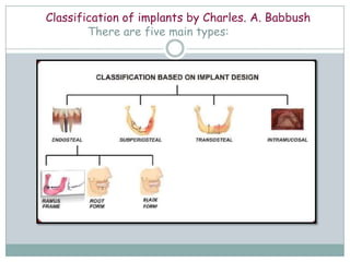 Classification of implants by Charles. A. Babbush
There are five main types:
 