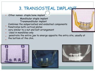 3. TRANSOSTEAL IMPLANT
 Other names- staple bone implant





Mandibular staple implant
Transmandibular implant
Combines the subperiosteal and endosteal components
Penetrates both cortical plates
very similar to a nut and bolt arrangement
Used in mandibles only
penetrate the entire jaw to emerge opposite the entry site, usually at
the bottom of the chin.
 