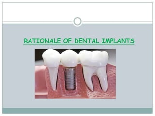 RATIONALE OF DENTAL IMPLANTS
 