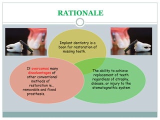RATIONALE
Implant dentistry is a
boon for restoration of
missing teeth.
It overcomes many
disadvantages of
other conventional
methods of
restoration ie.,
removable and fixed
prosthesis.
The ability to achieve
replacement of teeth
regardless of atrophy,
disease, or injury to the
stomatognathic system
 