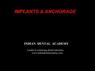 www.indiandentalacademy.com
INDIAN DENTAL ACADEMY
Leader in continuing dental education
www.indiandentalacademy.com
IMPLANTS & ANCHORAGE
 