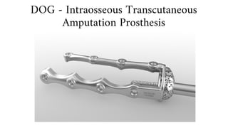 DOG - Intraosseous Transcutaneous
Amputation Prosthesis
 