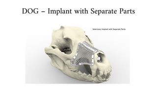 DOG – Implant with Separate Parts
 
