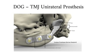 DOG – TMJ Unirateral Prosthesis
 