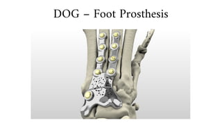 DOG – Foot Prosthesis
 