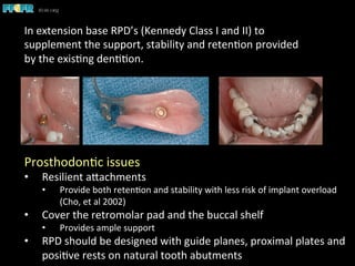 Implants and rp ds | PDF