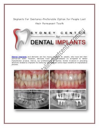 Implants for Dentures-Preferable Option for People Lost their Permanent Teeth