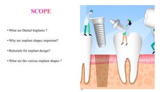 Dental IMPLANTS.pptx