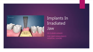 Implants In
Irradiated
Jaw
DR ZUBAIR AHMAD
PGR OMFS KEMU/MAYO
HOSPITAL LAHORE
 