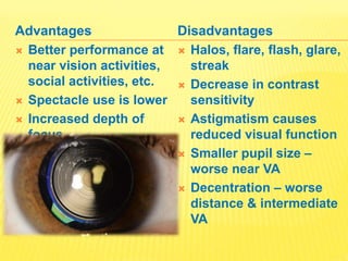 Implants in Ophthalmology | PPTX