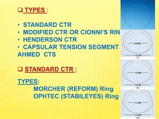 Implants in Ophthalmology | PPTX