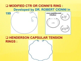 Implants in Ophthalmology | PPTX