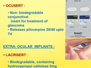 Ocuset Formulation Implants in Ophthalmology | PPTX