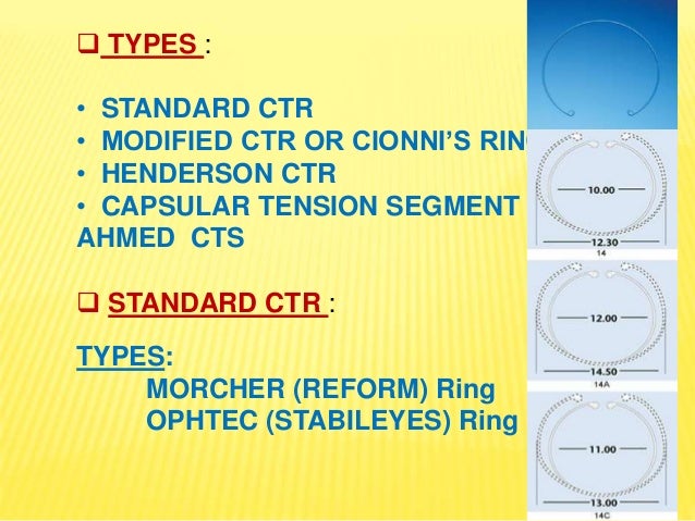 Cionni Ring Capsular Tension Ring Ppt Alcon Capsular Tension Ring