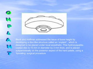 Block and Hoffman addressed the issue of bone height by
developing a disc-like structure called an ‘onplant’ , which is
designed to be placed under local anesthetic. This hydroxyapatite-
coated disc is 10 mm in diameter by 3 mm thick, and is placed
subperiosteally on the posterior aspect of the hard palate, using a
‘tunneling’ surgical procedure
 