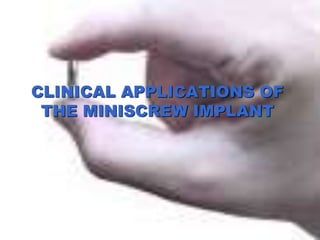 CLINICAL APPLICATIONS OF
THE MINISCREW IMPLANT
 