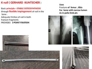 IMPORTANT IMPLANTS USED IN ORTHOPEDICS.pptx