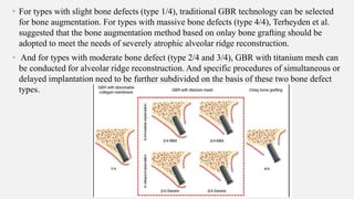 Implant Site Development Using Titanium Mesh in the.pptx
